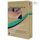 دوره آموزش طب سوزنی (متوسط)